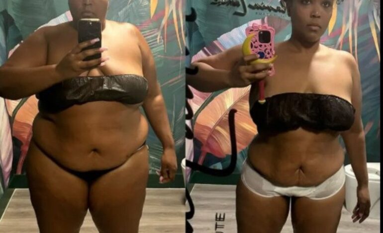 Lizzo’s NYFW Moment: A Bold Spotlight on Weight Loss and Confidence